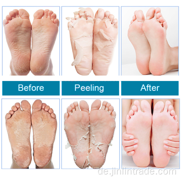 Extrakte Füße Peeling Peeling Peeling Foot Mask